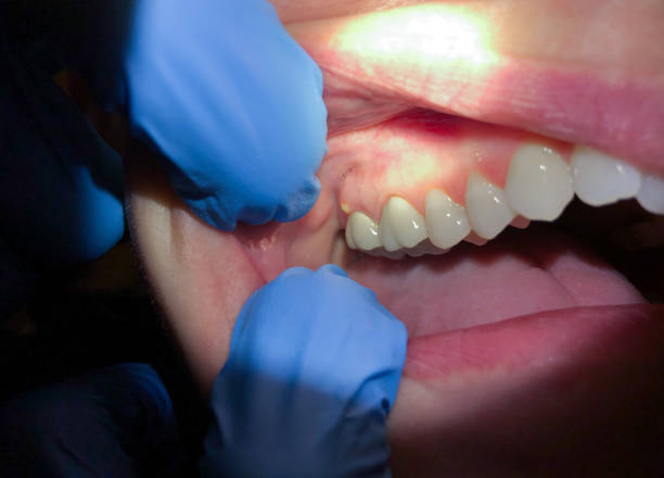 Best Emergency Cosmetic Dentistry (e.g., broken veneers) in St Robert, MO